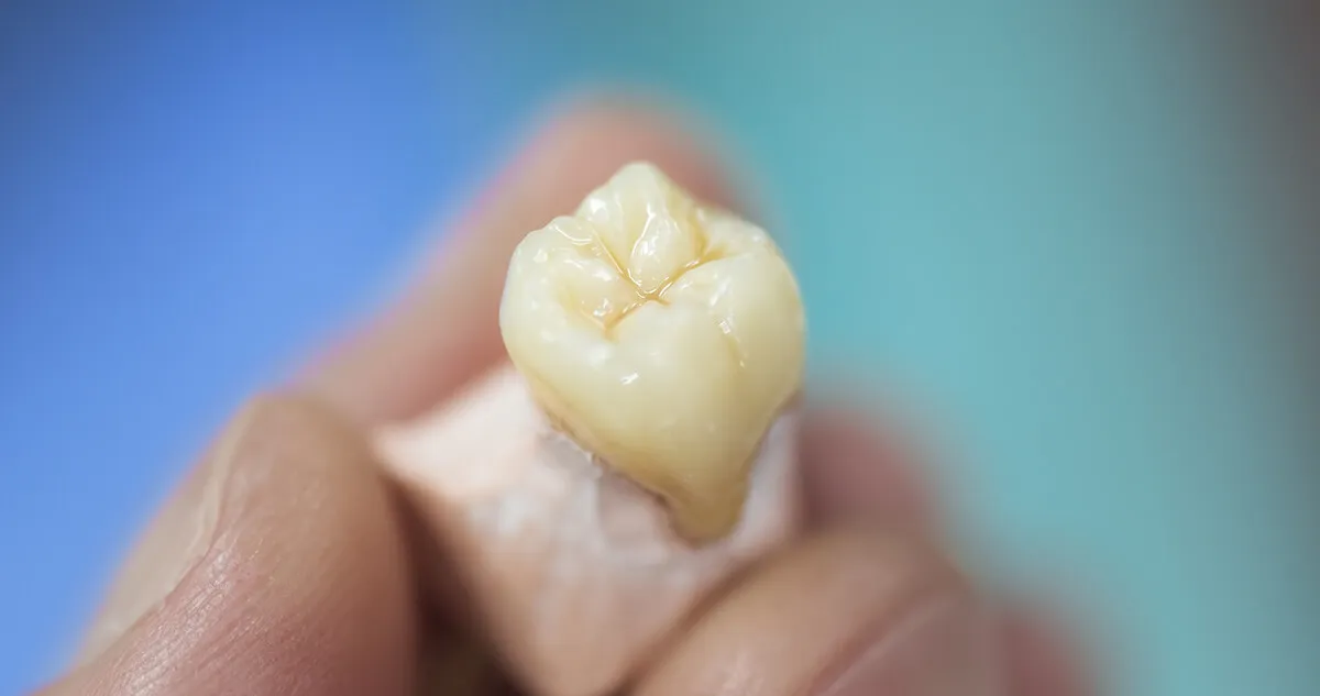 Zdjęcie Czy wypadające zęby zawsze oznaczają śmierć? Odkryj prawdę o snach