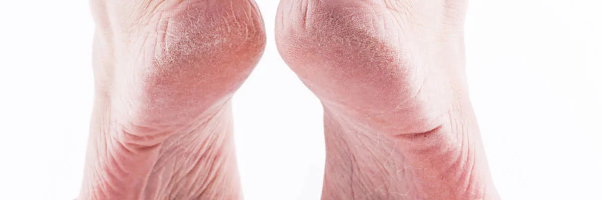 Zdjęcie Jak się pisze skóra? Uniknij powszechnych błędów w pisowni