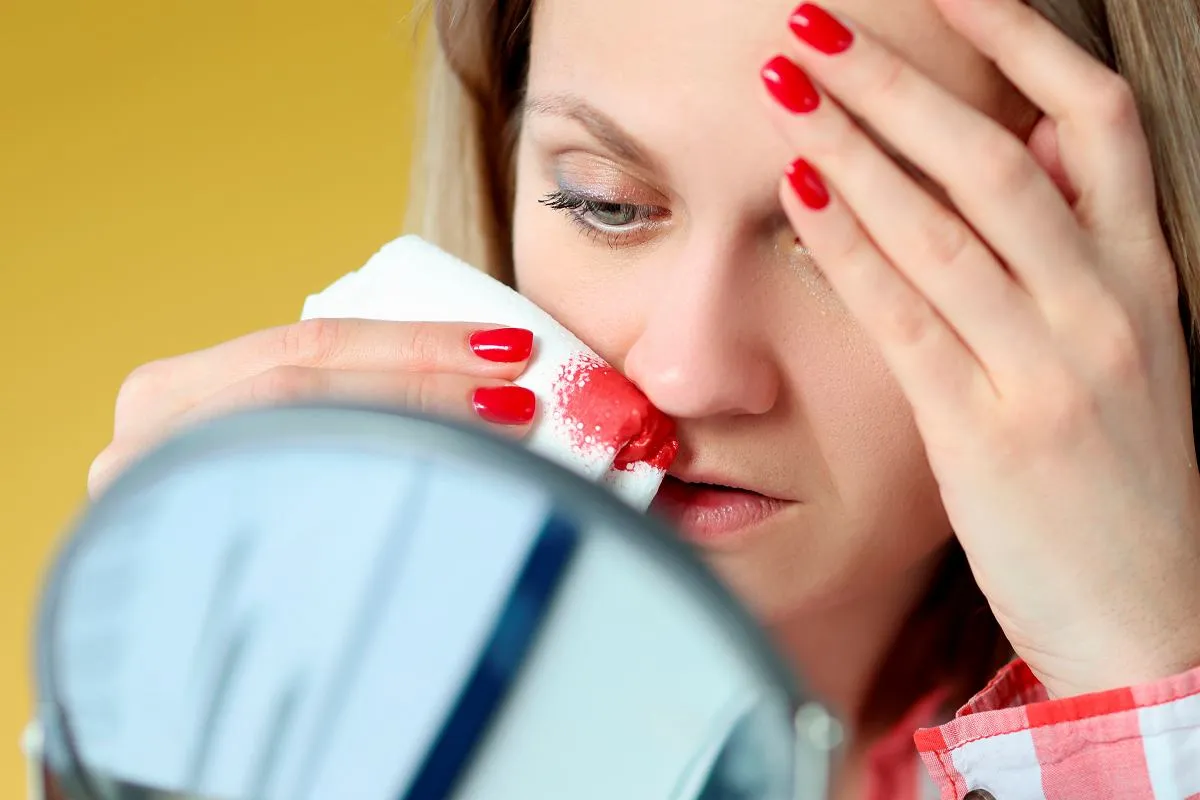 Zdjęcie Krwawienia z nosa przyczyna: najczęstsze powody i jak im zapobiegać