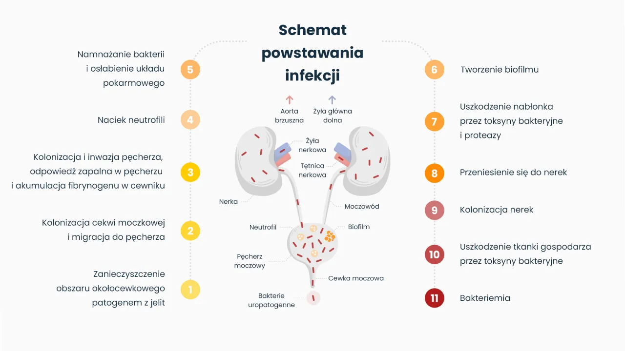 Zdjęcie Zapalenie cewki moczowej – objawy, powikłania i co zrobić w razie ich wystąpienia
