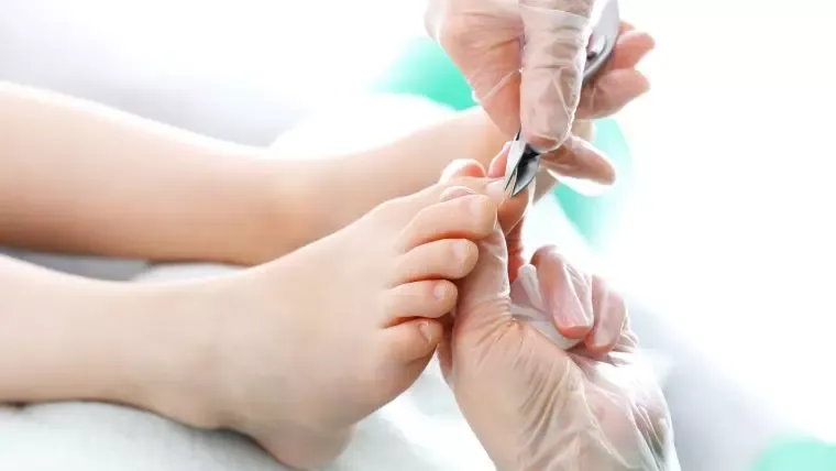 Zdjęcie Jak wyciąć wrastający paznokieć i uniknąć bólu oraz powikłań
