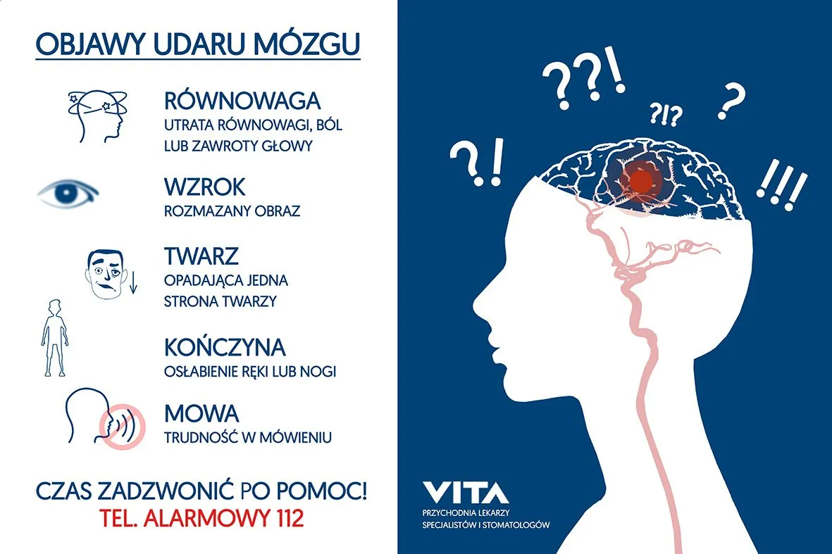 Zdjęcie Udar mózgu – przyczyny, objawy i skutki, których nie możesz ignorować
