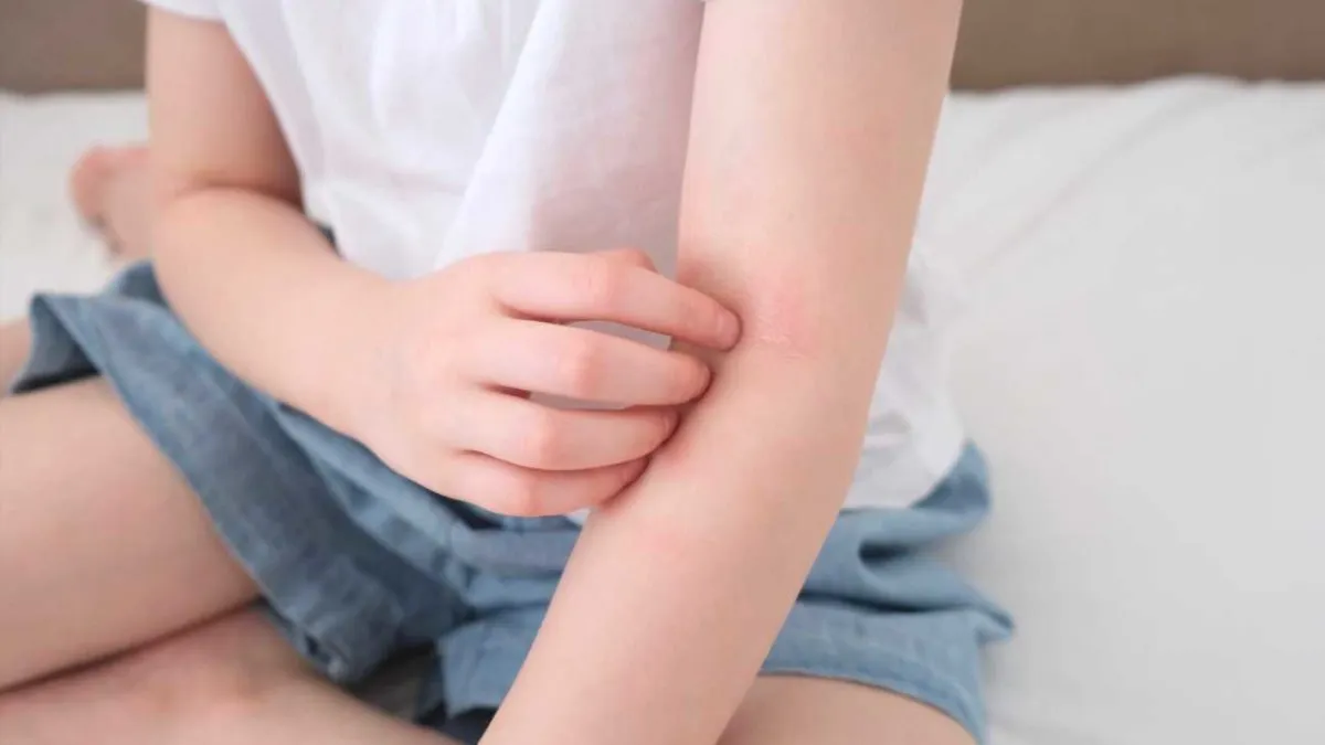 Zdjęcie Uczulenie na proszek do pieczenia objawy – nie bagatelizuj reakcji alergicznych