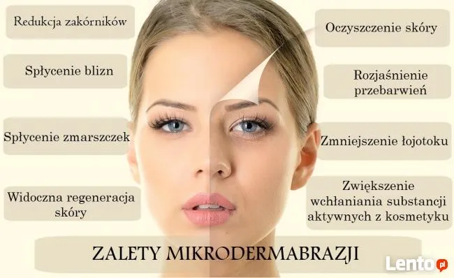 Zdjęcie Mikrodermabrazja diamentowa na czym polega i jakie przynosi efekty