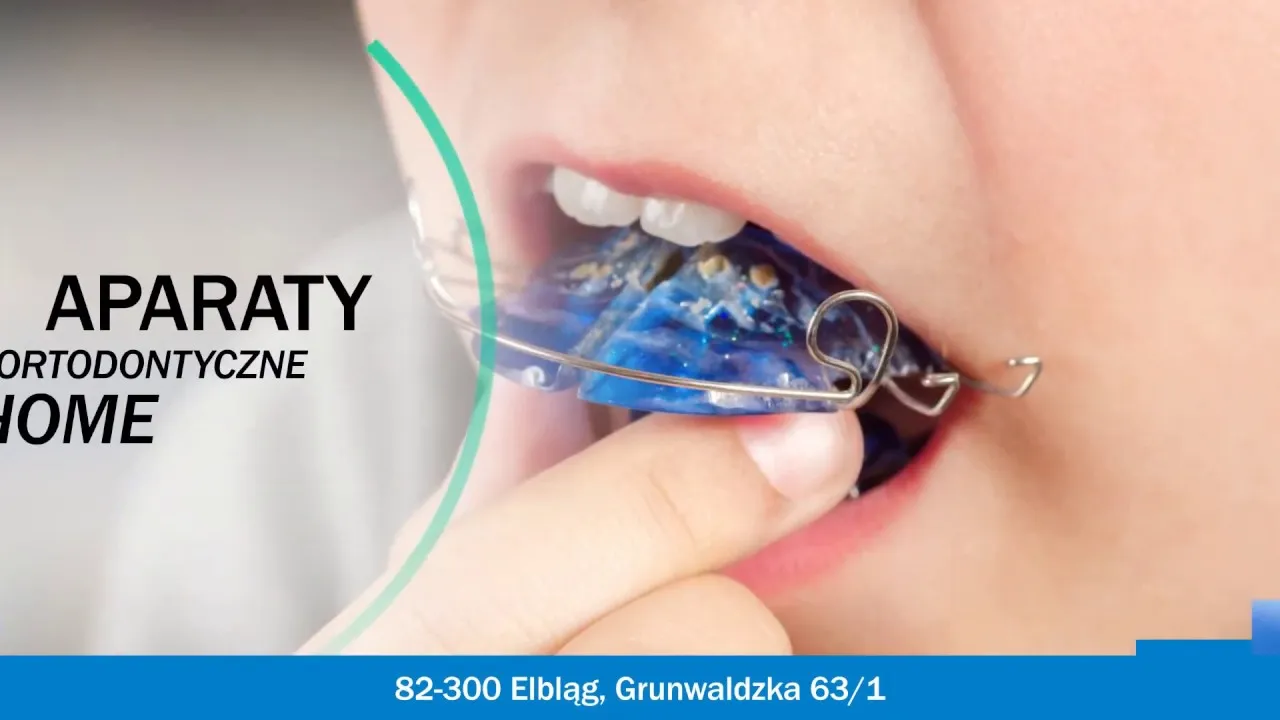 Zdjęcie Jak zakładać aparat ruchomy? Poradnik krok po kroku