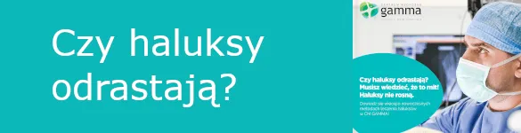 Zdjęcie Czy haluksy odrastają? Poznaj ryzyko nawrotu i jak go uniknąć