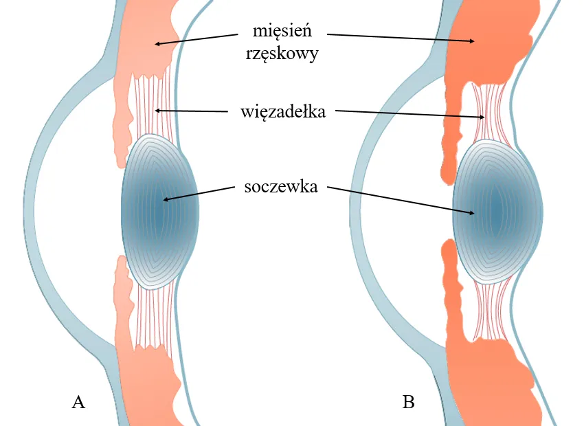 Zdjęcie Jak wygląda soczewka oka? Zaskakujące fakty o jej budowie i funkcji