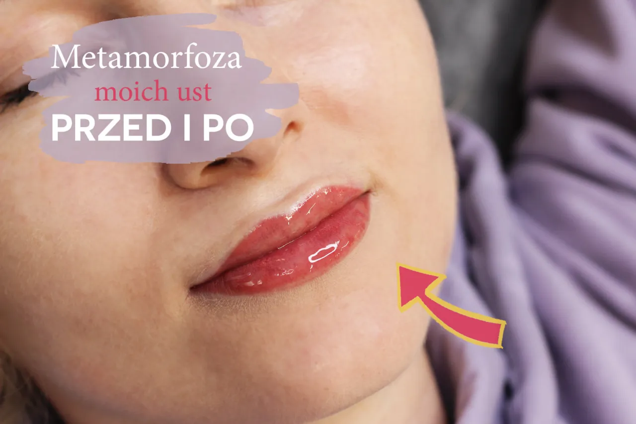 Zdjęcie Czy makijaż permanentny ust boli? Poznaj prawdę o bólu i znieczuleniu