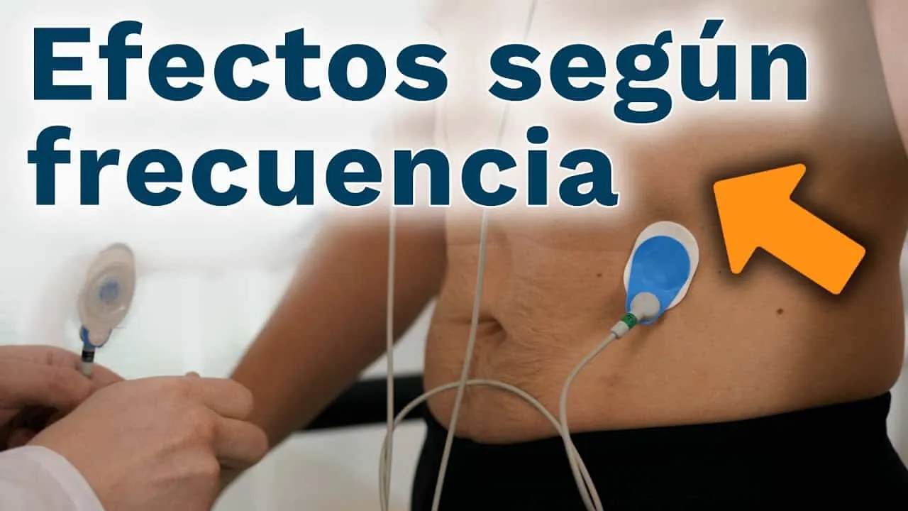 Zdjęcie Electroestimulación muscular: beneficios, riesgos y aplicaciones efectivas