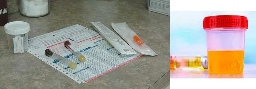 Zdjęcie Białko w moczu psa: co oznacza i jak należy postępować?