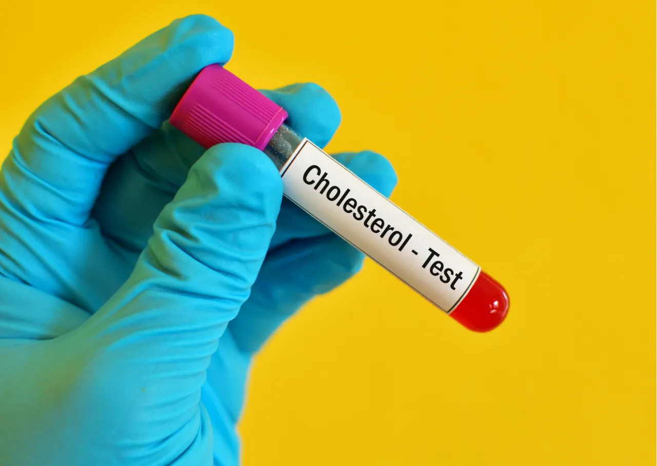 Zdjęcie Czego nie jeść przed badaniem cholesterolu, aby uniknąć błędnych wyników