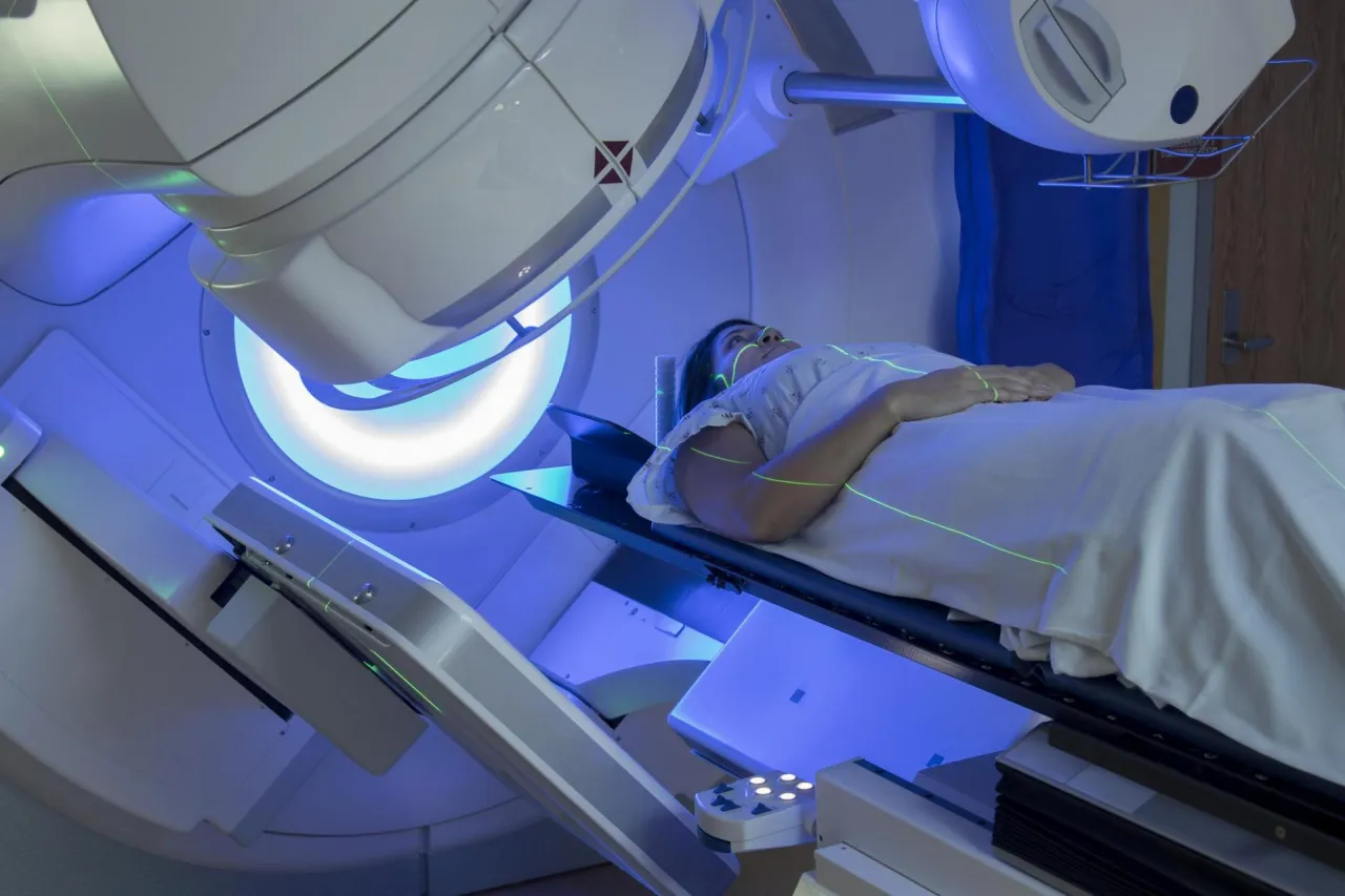 Zdjęcie Ile trwa radioterapia po operacji oszczędzającej pierś? Ważne informacje!