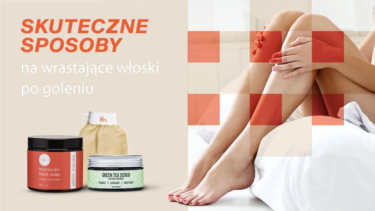 Zdjęcie Jak szybko pozbyć się krost po goleniu - skuteczne i proste sposoby