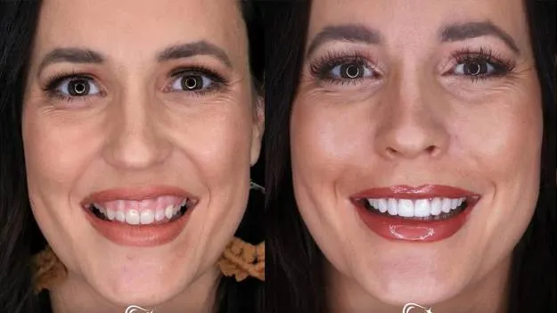 Zdjęcie Program Hollywood ile kosztuje? Sprawdź, co wpływa na cenę!