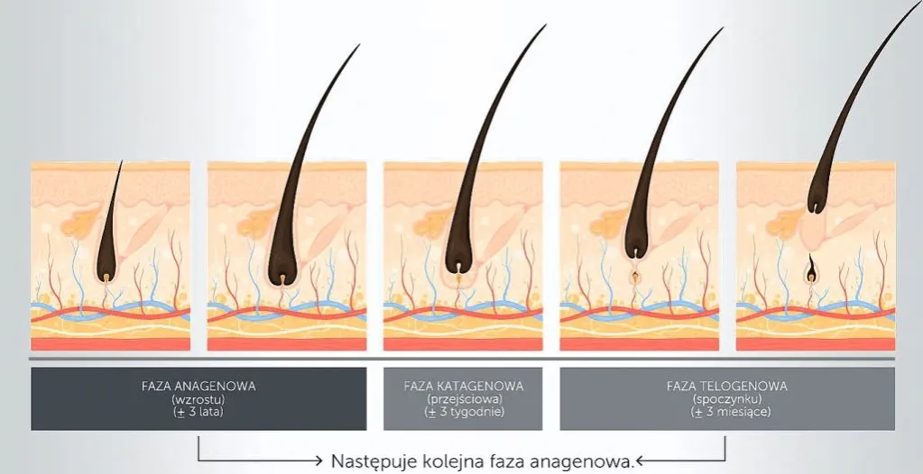 Zdjęcie Dlaczego włosy po depilacji laserowej odrastają? Oto zaskakujące powody