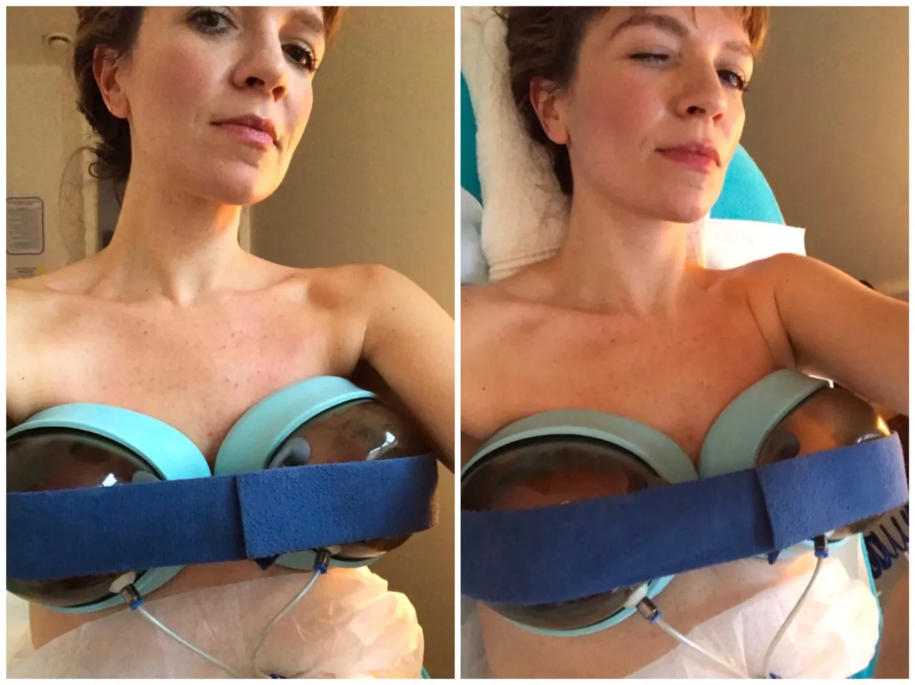 Zdjęcie Co z piersiami po zakończeniu karmienia? Oto, co musisz wiedzieć!