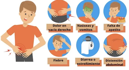 Zdjęcie Apendicitis: &iquest;Dolor com&uacute;n o urgencia? Identifica los s&iacute;ntomas clave.