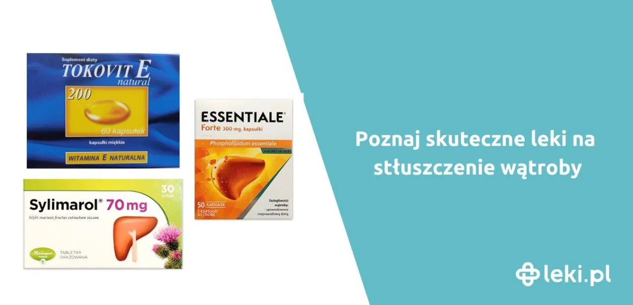 Zdjęcie Jakie leki na stłuszczenie wątroby mogą naprawdę pomóc w leczeniu?