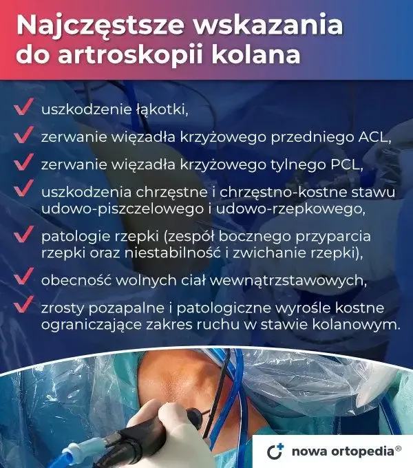 Zdjęcie Ile trwa rehabilitacja po artroskopii kolana? Oczekiwania i fakty