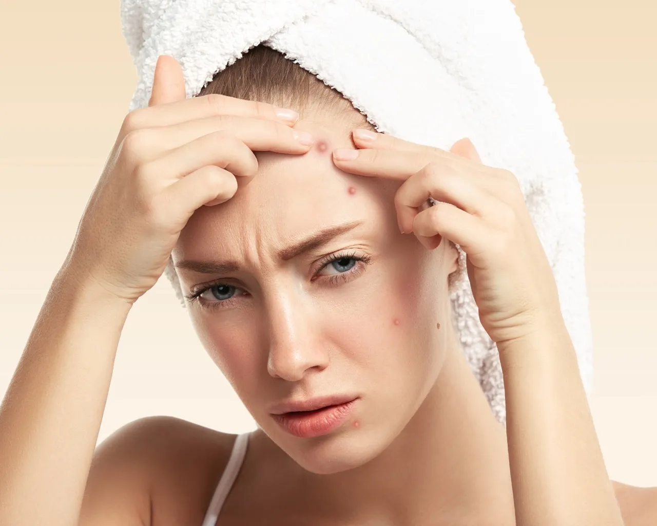 Zdjęcie Jak pozbyć się pryszczy na czole? Skuteczny poradnik