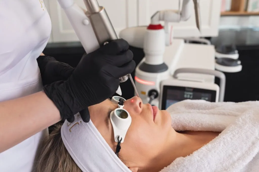 Zdjęcie Laser frakcyjny co ile: jak często robić zabiegi dla najlepszych efektów
