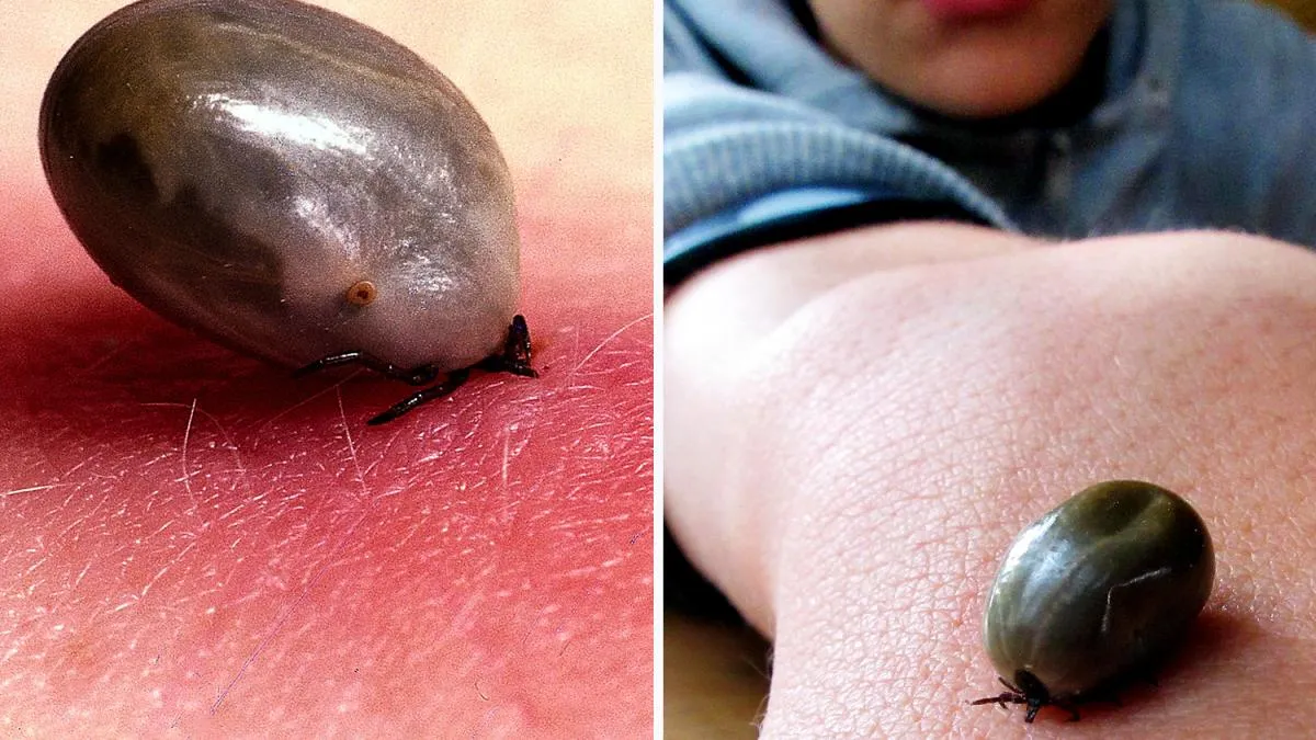 Zdjęcie Warum beißen Zecken nicht jeden? Die überraschenden Gründe erklärt