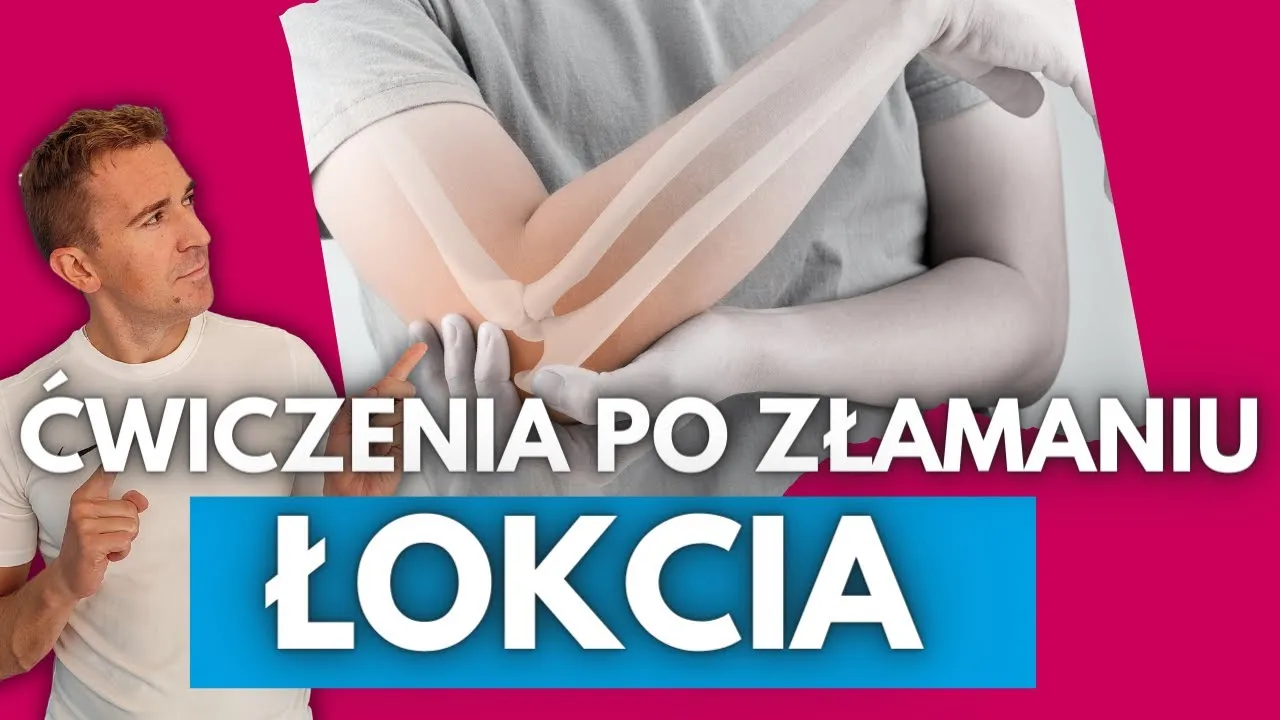 Zdjęcie Jakie ćwiczenia po złamaniu kłykcia pomogą w szybszej rehabilitacji?