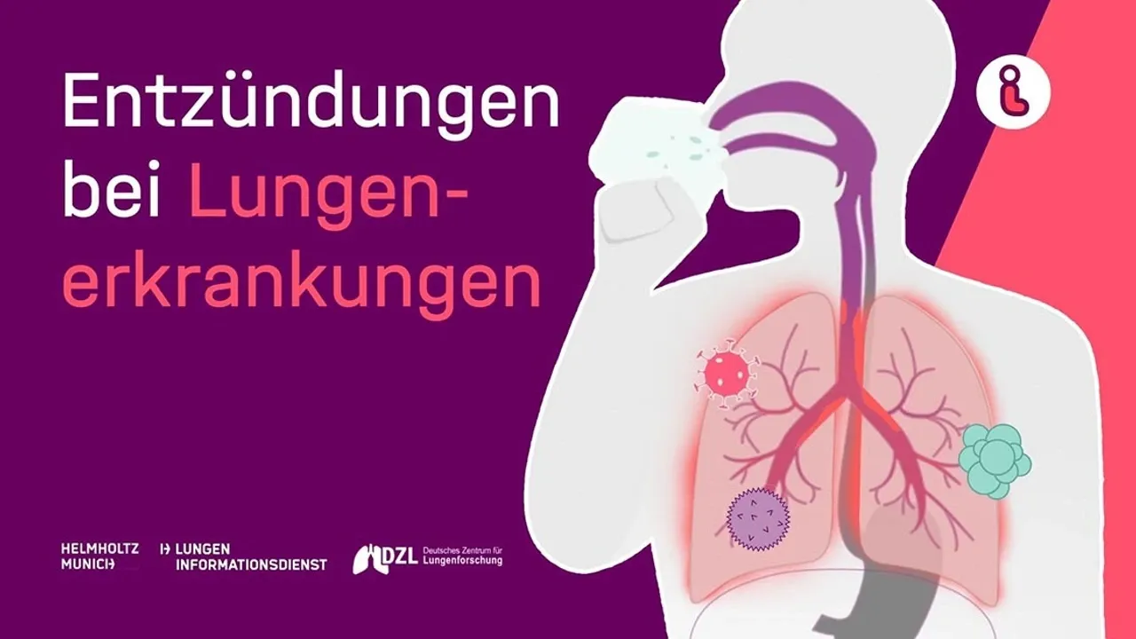 Zdjęcie Symptome bei einer Lungenentzündung: So erkennen Sie die Anzeichen