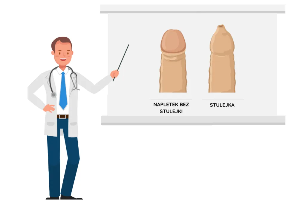 Zdjęcie Stulejka urolog czy chirurg: Kto najlepiej pomoże w leczeniu?