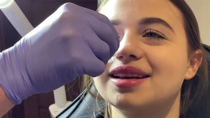 Zdjęcie Jak włożyć kolczyk do nosa bez bólu - krok po kroku dla początkujących