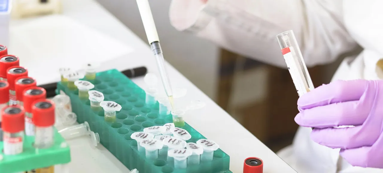 Zdjęcie Proyectos de investigación médica en Andalucía: oportunidades y avances