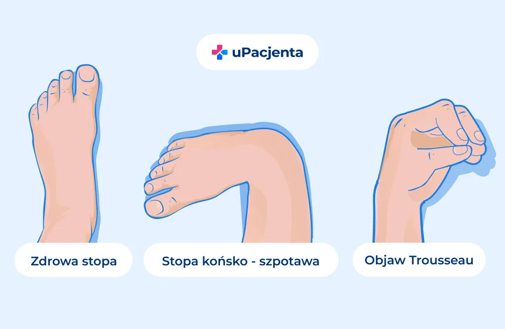 Zdjęcie Tężyczka: jakie badania są kluczowe dla diagnozy? Sprawdź listę
