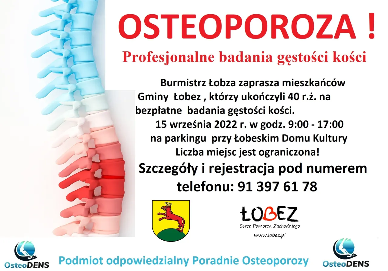 Zdjęcie Osteoporoza: do jakiego lekarza się udać i jak uniknąć powikłań?
