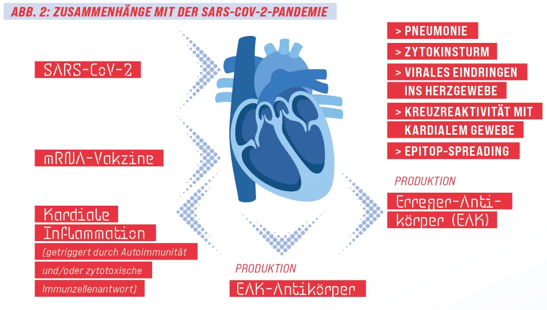 Zdjęcie Myokarditis Symptome: Warnsignale, die Sie nicht ignorieren sollten