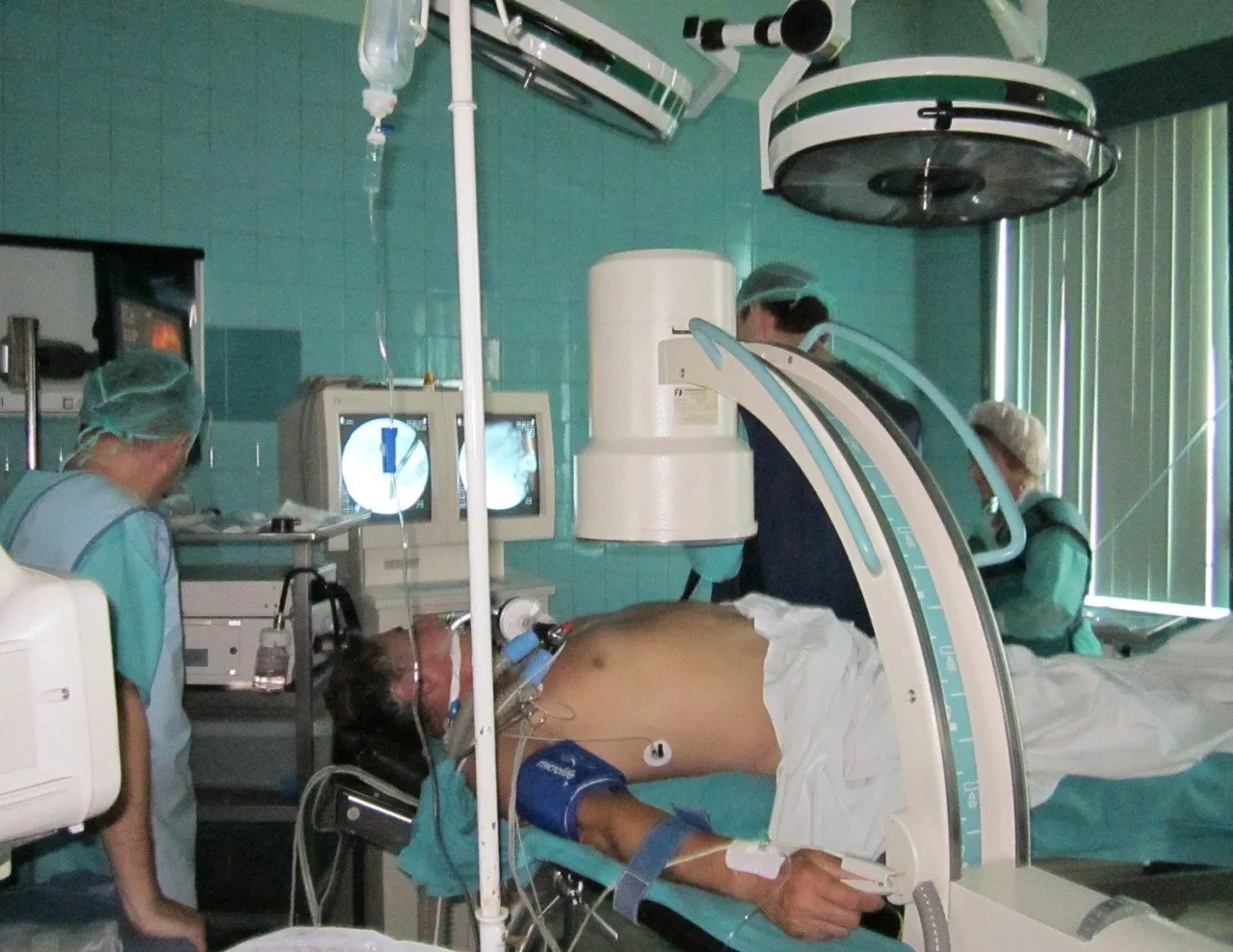 Zdjęcie Badanie ERCP na czym polega: wszystko, co musisz wiedzieć o procedurze