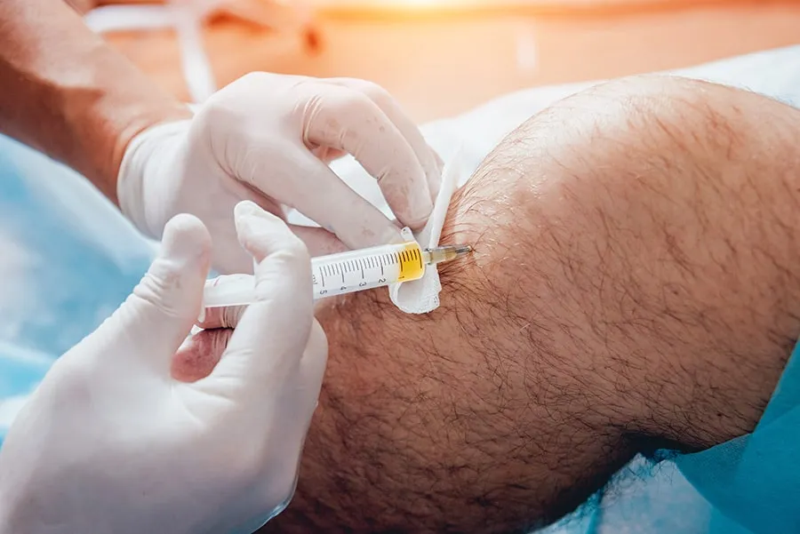 Zdjęcie Ile kosztuje kwas hialuronowy w kolano? Sprawdź ceny i opcje terapii