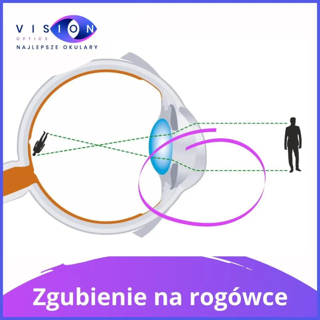 Zdjęcie Astygmatyzm – kiedy nosić okulary, aby uniknąć problemów z widzeniem