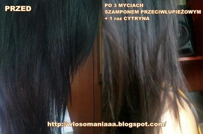 Zdjęcie Jak skutecznie rozjaśnić za ciemne włosy po farbowaniu w domowych warunkach