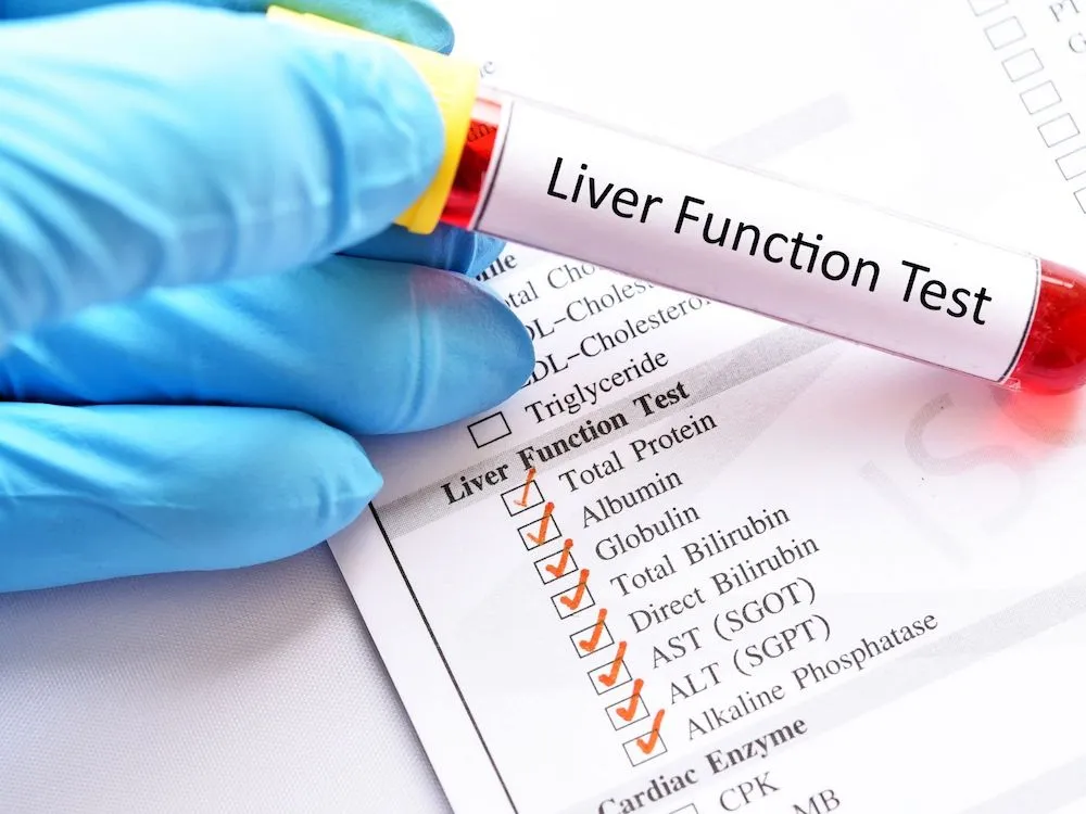 ALAT co to za badania i dlaczego są kluczowe dla zdrowia wątroby