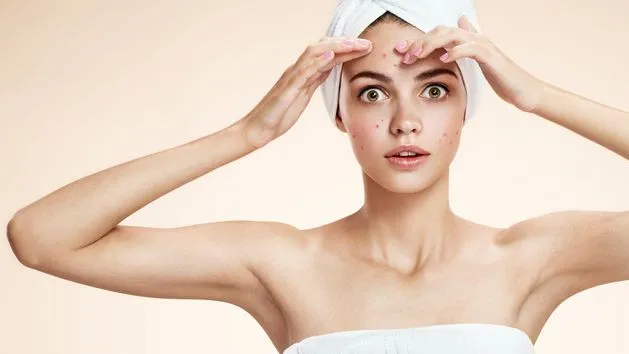 Jak ukryć pryszcze bez makijażu - naturalne metody na niedoskonałości