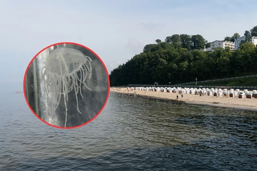 Czy meduzy w Bałtyku są groźne? Poznaj niebezpieczeństwa i zagrożenia