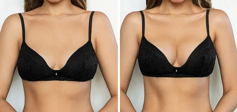 Co na powiększenie biustu forum – sprawdzone metody i opinie użytkowników