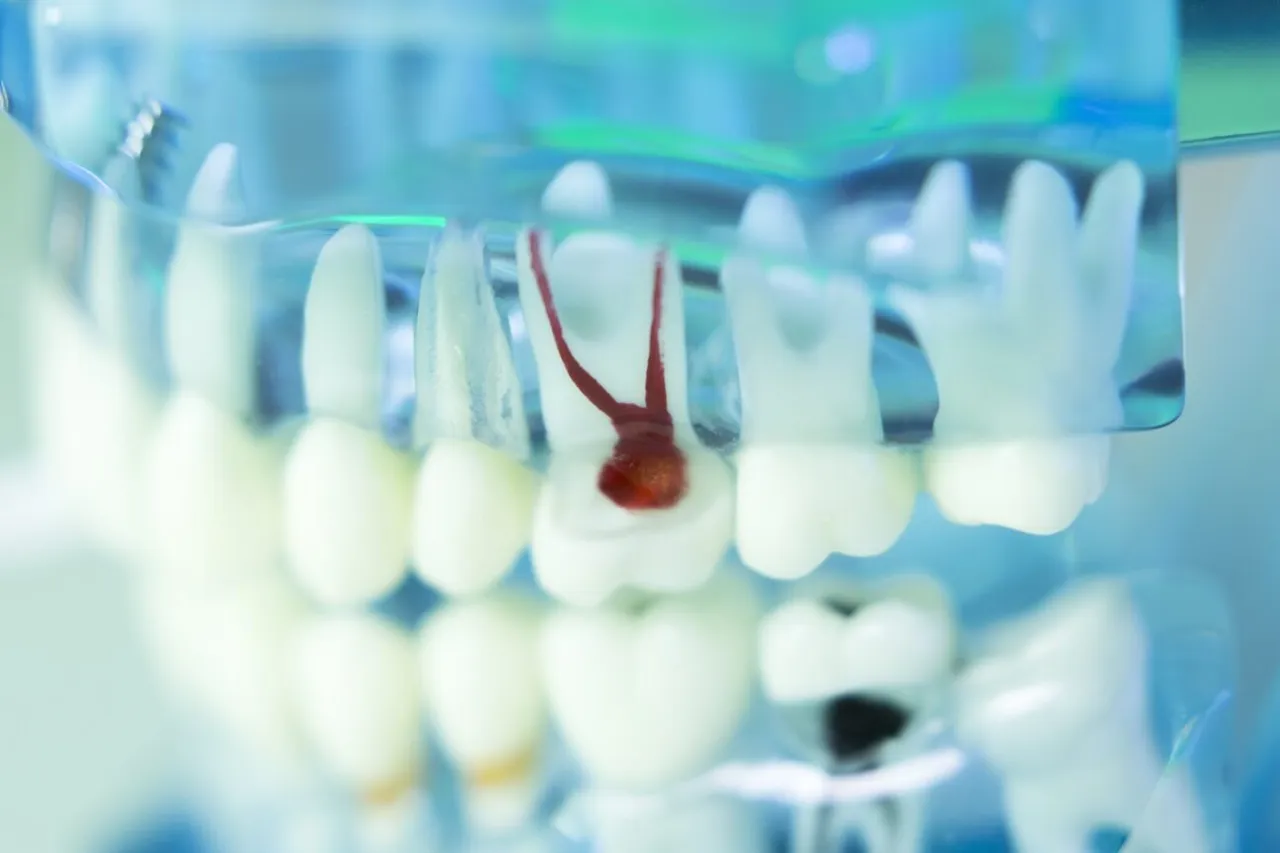 Jak zatruć zęba w domu i uniknąć poważnych komplikacji zdrowotnych