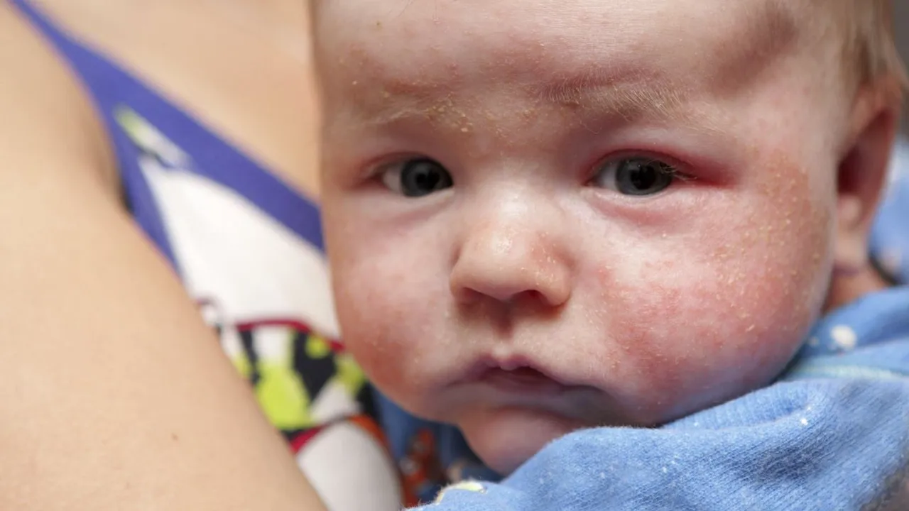 Nietolerancja pokarmowa u niemowląt: Objawy, które każdy rodzic musi znać