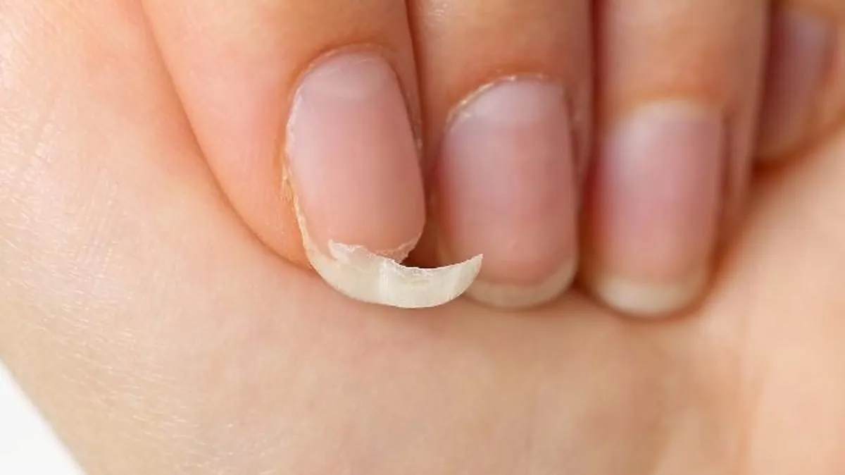 Czy złamany paznokieć się zrośnie? Sprawdź, co musisz wiedzieć