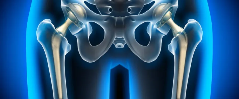 Czy ból biodra może promieniować do brzucha? Odkryj przyczyny i objawy