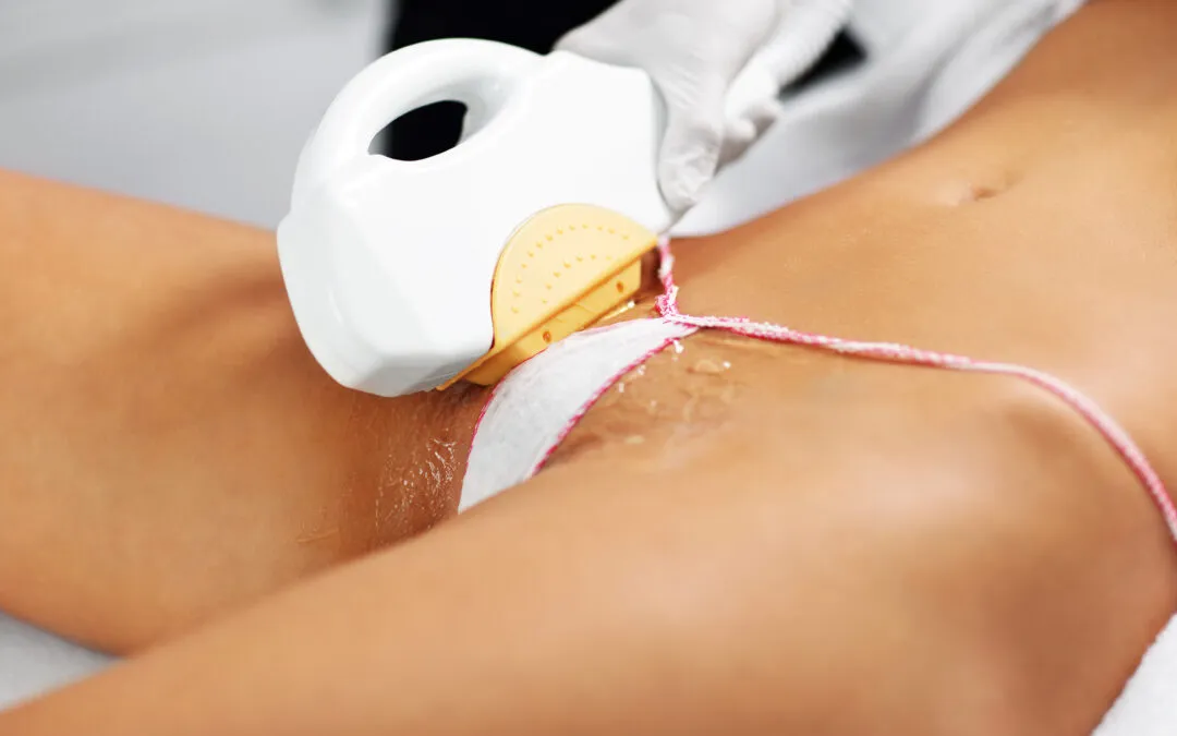 Jak wygląda depilacja bikini? Przewodnik bez tajemnic i bólu?