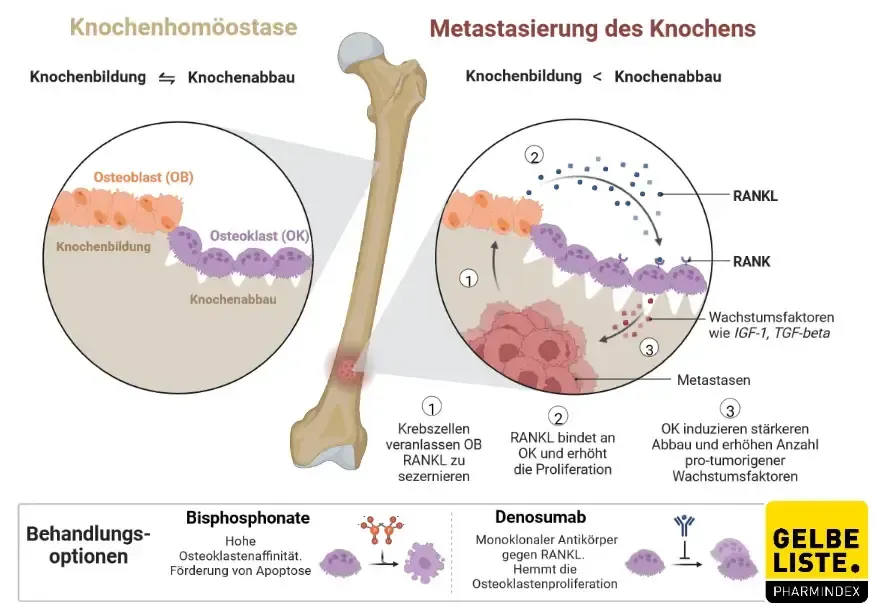 Osteoporose-Medikamente: Wirkstoffe, Wirkung & Vorteile erklärt