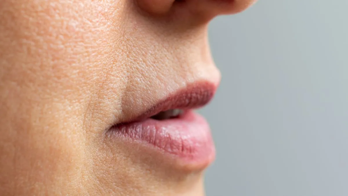 Jak usunąć kwas hialuronowy z ust domowe sposoby, które nie działają