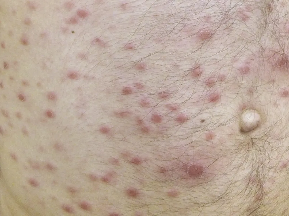 Blady jak ściana: co oznacza i jakie są jego przyczyny?